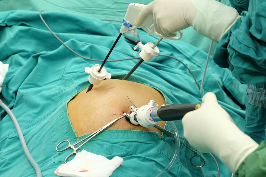 Best Gallbladder Stone Surgeon in Vadodara, Gujarat